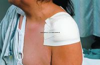 3M© 3M Microfoam Surgical Tape - Sku MMM15282_BX6