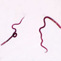 Trichinella spiralis Female, w.m. Microscope Slide