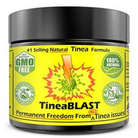 Tinea Versicolor Treatment Cream FAST Relief than soap, Body wash, Lotion Ointment & Shampoo. 12x Best Natural Anti Fungal in Market for Tinea Pedia Tinea Cruris Tinea Capitis (scalp) Tinea corporis