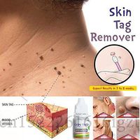 Skin Tag Remover 12 hours Tu kill Medical Tu kill Remover Skin Tag Mole & Genital Wart Remover Dropshipping
