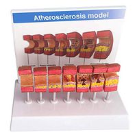 LXX Human Artery Anatomy Model - Anatomical Vessel Atherosclerosis Thrombus Vascular Model - Educative Learning Training Aid Lab Supplies
