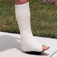 DM Systems Inc CastWalker, Regular Size Kit