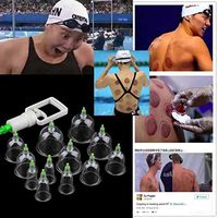 KOOYUTA 12-Cup Medical Vacuum Biomagnetic Chinese Cupping Therapy Device Set Effective Healthy (12pcs)