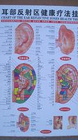 Acupuncture English & Chinese Ear Chart 25' X 18" Waterproof