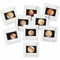 Diseases of the Ear Projection Slides, Diagnostic & Procedural Ear Trainer