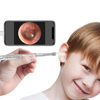 Teslong Otoscope, 720P Washable Ear Cleaner with Light, Waterproof Ear Wax Removal Tool Kit for Android, Windows & MacBook Device, 4.3mm Ultra-Slim for Kids Adults