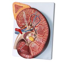 LXX Scientific Human Anatomy,Human Kidney Anatomical Model Adrenal Gland Model Urinary Nephrology Doctor-Patient Communication Model