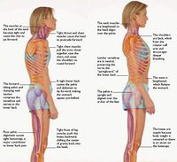 Posture Corrector for Children and Teenagers