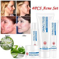 Acne Remove Tool Set, Elevin(TM) Skin Care Set Acne Treatment Deep Skin Cleanser Skin Cleansing Oil Control Removal Cream