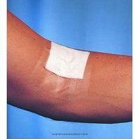 3M Blenderm Surgical Tape BLENDERM PLSTC TAPE 1 IN X5 Box of 12 3M 15251