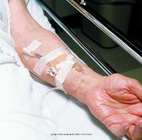 3M Durapore Surgical Tape-Size: 1" x 10 yd (2.5 cm x 9.14 m) - UOM = Each 1