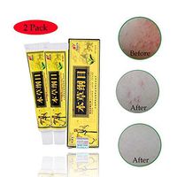 2Pcs/Lot High Quality Chinese Herbal Eczema, Psoriasis Creams Dermatitis and Eczema Pruritus Psoriasis CEZUBEM Ointment