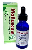 MolluscumRx Eliminates Molluscum! Baby Safe! REFERRED & Sold by Dermatologists Nationwide! Pain-Free! Organic! Guaranteed!