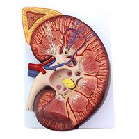 LXX Kidney Anatomical Model Zoom in 3 Times Renal Adrenal Gland Anatomy Genitourinary for Doctor-Patient Communication Medical Educational Training Aid
