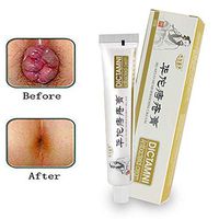 5pcs Chinese Herbal for Treatment Hemorrhoids Cream Anus Prolapse Anal Fissure Antibacterial Cream 20g