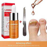 Nail Fungus Treatment, Shouhengda Premium Fungal Nail Treatment Nail Whitener, Finger and Toe Nail Fungus Treatment Essence