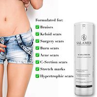 Doctor Salameh Scar and Bruise Cream Reduces The Appearance of Scars and Skin Discoloration with Arnica Oil and Vitamins K and E (1 oz)