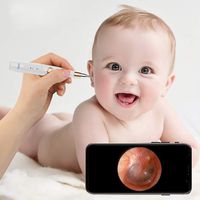 SUNGLIFE Wireless Otoscope, 3.9mm Ultra-Thin WiFi HD Ear Inspection Camera,  HD 1080P Visual Ear Cleaning Endoscope with 6 Adjustable LEDs for iOS and Android Smartphone and Tablet