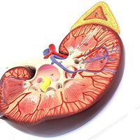 LXX Human Kidney Model -3X Magnification Renal Adrenal Gland Anatomy Genitourinary Model,PVC Material Human Anatomy Science Models for Doctor-Patient Communication,Science Kit