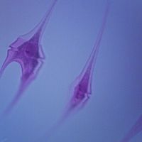 Ceratium, w.m. Microscope Slide