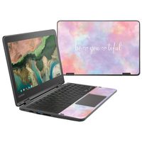 MightySkins Skin Compatible with Lenovo 300e Chromebook 11.6" (2018) - BeYouTiful | Protective, Durable, and Unique Vinyl Decal wrap Cover | Easy to Apply, Remove, and Change Styles | Made in The USA