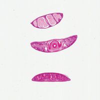 Planaria, c.s, Three Different Body Regions Microscope Slide