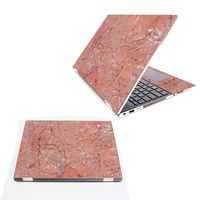 Mightyskins Skin Compatible With Hp Spectre X360 15.6" (2018) - Pink Marble | Protective, Durable, And Unique Vinyl Decal Wrap Cover | Easy To Apply, Remove, And Change Styles | Made In The Usa