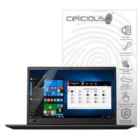 Celicious Matte Anti-Glare Screen Protector Film Compatible with Lenovo ThinkPad P1 P2000 (Touch) [Pack of 2]