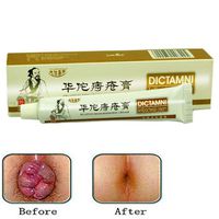 Atoking Natrual Hemorrhoids Cream Anal Cream for Internal Hemorrhoids Piles External Anal Fissure