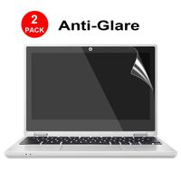 [2PCS] 14-inch Laptop/chromebook Crystal Clear Screen Protector,Notebook Computer Screen Guard Protector for HP/DELL/Asus/Acer/Samsung/Lenovo/Toshiba chromebook,Laptop etc,Display 16:9