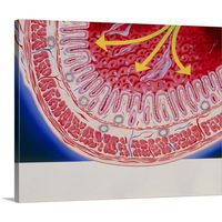 Artwork of a Laxative in The Large intestine Canvas Wall Art Print, 20"x16"x1.25"