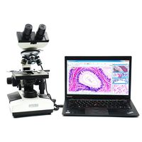 OPTO-EDU A31.1007-3.0M Digital Biological Compound Binocular LED Light Microscope with Double Layer Mechanical Stage Oil Immersion, Built-in 3.0MP Camera 40X-2000X, Metal, Glass, Plastic