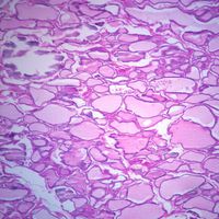 Human Thyroid, sec. 7 m H&E Microscope Slide