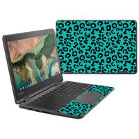 MightySkins Skin Compatible with Lenovo 300e Chromebook 11.6" (2018) - Teal Leopard | Protective, Durable, and Unique Vinyl Decal wrap Cover | Easy to Apply, Remove | Made in The USA