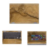 Decalrus - Protective Decal Skin Skins Sticker for Acer Convertible ChromeBook 11 R11- CB5-132T, R11-C738T (11.6" Screen) case Cover wrap ACchromebookR11-172