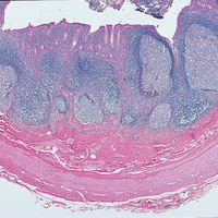 Human Appendix, c.s. sec. 7 m H&E Microscope Slide