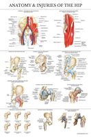 Laminated Anatomy and Injuries of The Hip Poster - Hip Joint Anatomical Chart - 18" x 27"