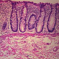 Human Colon Slide, c.s, 7 m, H&E