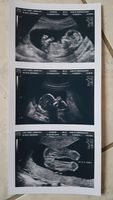 Prank 2D Customized Ultrasound Strip of 3 Photos